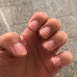 Post acrylic removal