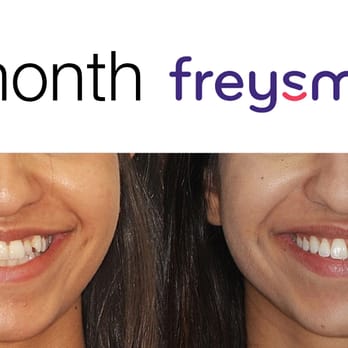 Freysmiles Orthodontics - Orthodontists Near Me - Bethlehem, Pennsylvania
