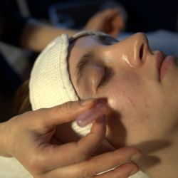 Fany Esthetics - Facial cupping