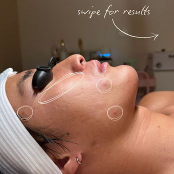 Skin Served - Waxing Near Me - Newport Beach, California Skin Served - Waxing Near Me - Newport Beach, California