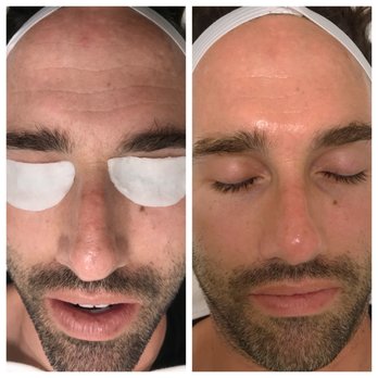 Kali Glow Skincare - Men's facial. - Skin Care Near Me - Hermosa Beach, California Kali Glow Skincare - Men's facial. - Skin Care Near Me - Hermosa Beach, California