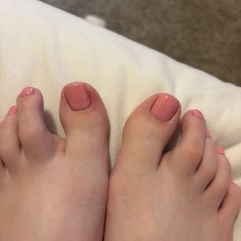 LA Nails & Spa - Left toe infected vs right toe normal - Nail Salons Near Me - Downey, California LA Nails & Spa - Left toe infected vs right toe normal - Nail Salons Near Me - Downey, California