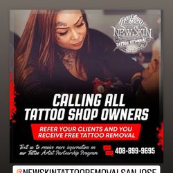 New Skin Tattoo Removal