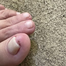 Toe