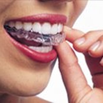 Pasadena Smile Center - Invisalign - Cosmetic Dentists Near Me - Pasadena, California Pasadena Smile Center - Invisalign - Cosmetic Dentists Near Me - Pasadena, California