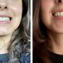 Serrano Orthodontics