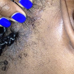 Flokay Hair Braiding Salon - I developed a rash from the Shampoo or dirty tools Flokay Hair Braiding used