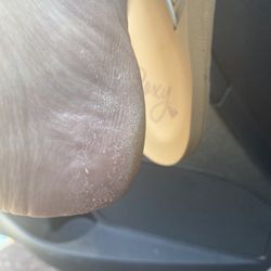 iNails - She scraped all my skin off