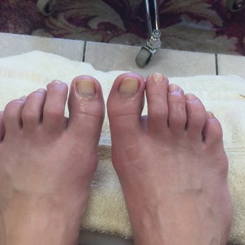 Hot Nails - After polish was removed. - Nail Salons Near Me - Colorado Springs, Colorado Hot Nails - After polish was removed. - Nail Salons Near Me - Colorado Springs, Colorado