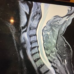 Alexander Imas, MD - Cervical Spine