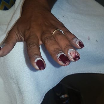 Super Nails - They claimed that this was normal - Nail Salons Near Me - Acworth, Georgia