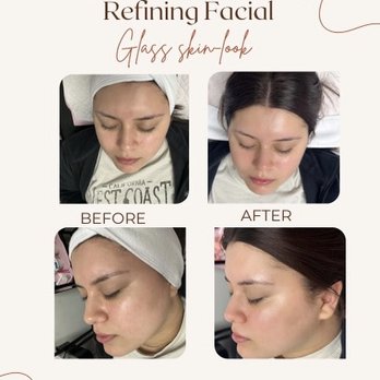 Infiniteglowspa - Skin Care Near Me - Mesquite , Texas Infiniteglowspa - Skin Care Near Me - Mesquite , Texas