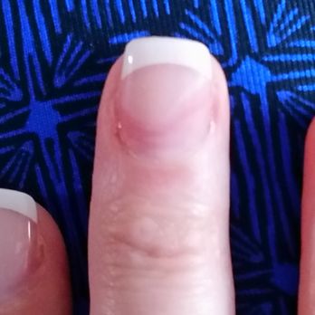 C K Nails - Just look how bad my nails look. 8 out of 10 nails were bad. - Nail Salons Near Me - Pineville, North Carolina