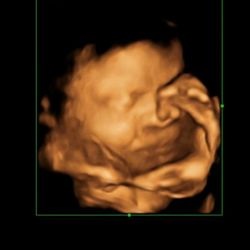 Enso Prenatal & 3D/4D Ultrasounds - 3D Ultrasound