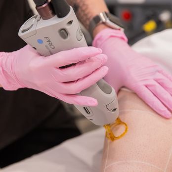 Alite Laser - Cedar Park - Laser Hair Removal Near Me - Cedar Park, Texas