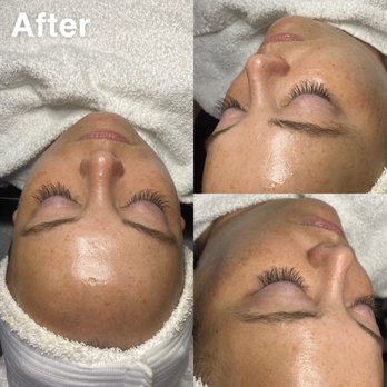 Lotus Oasis Esthetics - Facial - Estheticians Near Me - Floresville, Texas Lotus Oasis Esthetics - Facial - Estheticians Near Me - Floresville, Texas