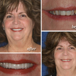 Biltmore Dental Center - Cathy's Smile Gallery