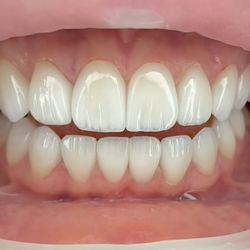 The Smile Patio Orthodontics - Smile alignment .