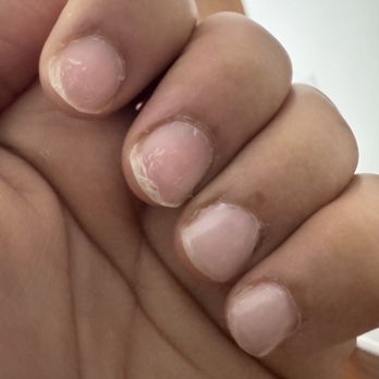 A Artistic Nail Salon - UPDATE: Day 2 of manicure and two of the hard gels already popped off of my finger. Worst manicure ever. - Nail Salons Near Me - Grass Valley, California A Artistic Nail Salon - UPDATE: Day 2 of manicure and two of the hard gels already popped off of my finger. Worst manicure ever. - Nail Salons Near Me - Grass Valley, California
