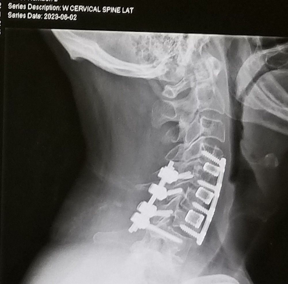 Good Samaritan Medical Center - patient advocate in Lafayette, CO