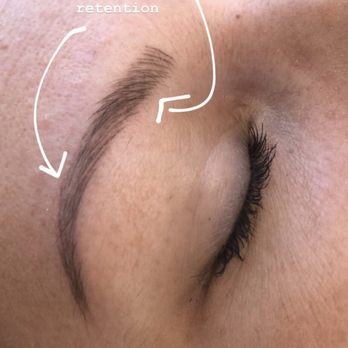 The Highbrow - Before touch up no make up - Hair Removal Near Me - Newport Beach, California The Highbrow - Before touch up no make up - Hair Removal Near Me - Newport Beach, California