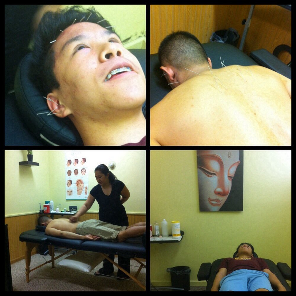 Healing Acupuncture, LLC - My brother & son getting acupuncture... - Acupuncture Near Me - Milwaukee, Wisconsin Healing Acupuncture, LLC - My brother & son getting acupuncture... - Acupuncture Near Me - Milwaukee, Wisconsin