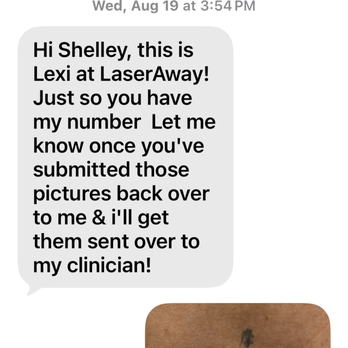LaserAway - Tattoo Removal Near Me - Woodlands, Texas