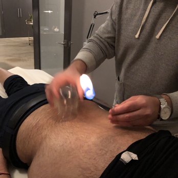 Acuworx Acupuncture Studio - Cupping totally relaxed my back. - Acupuncture Near Me - Jersey City, New Jersey Acuworx Acupuncture Studio - Cupping totally relaxed my back. - Acupuncture Near Me - Jersey City, New Jersey
