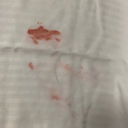 Disgusting lipstick on pillow case