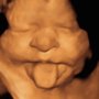 Womb With A View Ultrasound