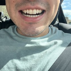 Repaired smile
