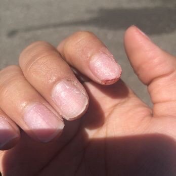 Tina's Nail Spa - My nails after I had to go to a DIFFERENT salon to get them to take them off - Nail Salons Near Me - Hendersonville, Tennessee
