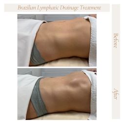 Madam Body - Lymphatic Drainage