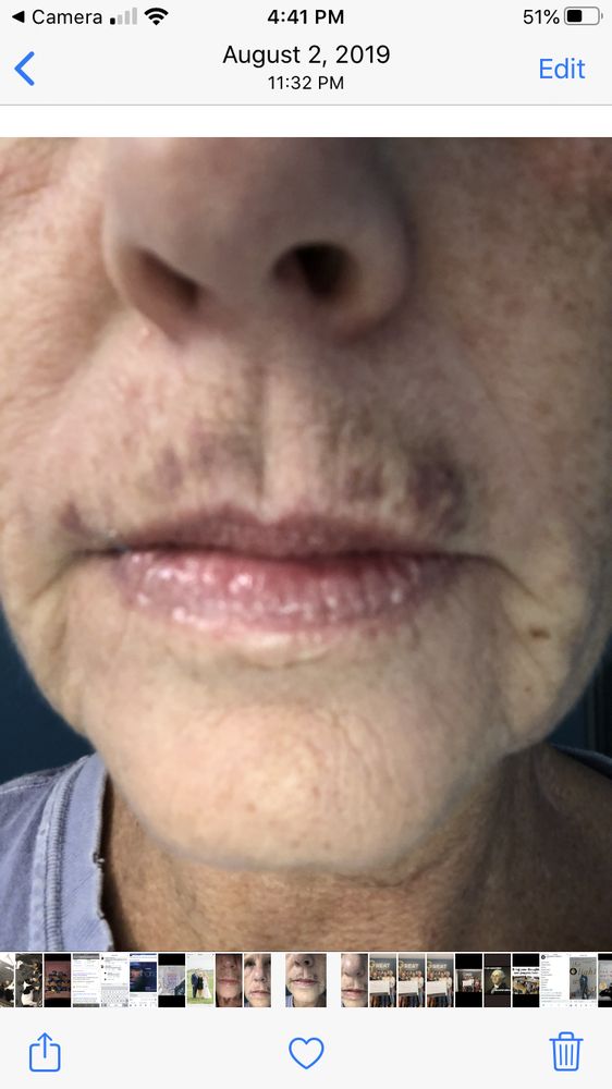 BRANDYWINE MED SPA Updated May 2024 69 Photos 940 E Baltimore