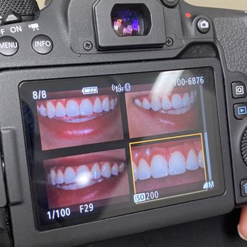 Nick Addario, DDS - after - Cosmetic Dentists Near Me - Chula Vista, California Nick Addario, DDS - after - Cosmetic Dentists Near Me - Chula Vista, California