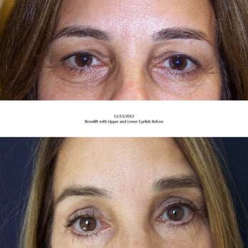 RevivaMed Plastic Surgery - Skin Care Near Me - La Jolla, California