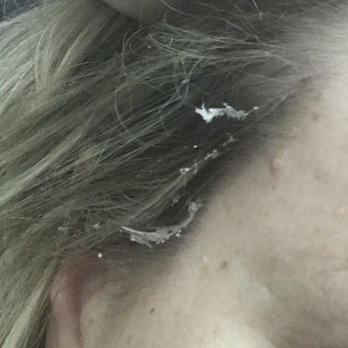Emma Beauty Salon - They put a shower cap on my head but then got the peel-off facial product in my hairline and left me to clean it out after I left. - Hair Salons Near Me - Lynbrook, New York Emma Beauty Salon - They put a shower cap on my head but then got the peel-off facial product in my hairline and left me to clean it out after I left. - Hair Salons Near Me - Lynbrook, New York