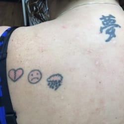 Advanced Laser Clinics - Before...