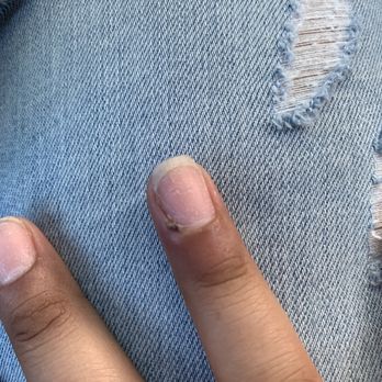 Senses Nails & Spa - My finger looks gross!! Thanks senses for everything it shows how much you value your customers. - Nail Salons Near Me - San Mateo, California Senses Nails & Spa - My finger looks gross!! Thanks senses for everything it shows how much you value your customers. - Nail Salons Near Me - San Mateo, California