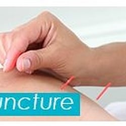 Four Gates Acupuncture
