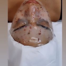 Touch Laser Spa