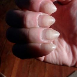 They cut my finger open I saw a live ROACH!!! me and my friend were going in there to treat ourselves for her birthday and get this!