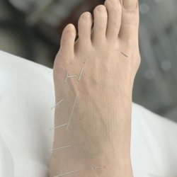Join Acupuncture & Herbal Medicine