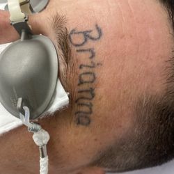 Vanish Laser Services - Removal of prison tattoos are discounted. This is immediately after the first session. The ink will get dark again as your body clears it.