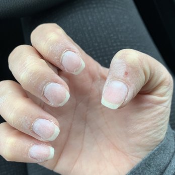 Ben's Nails - My nails when I walked in.. before Tina worked her magic. - Nail Salons Near Me - Redlands, California Ben's Nails - My nails when I walked in.. before Tina worked her magic. - Nail Salons Near Me - Redlands, California