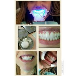 Denise Acierno DDS