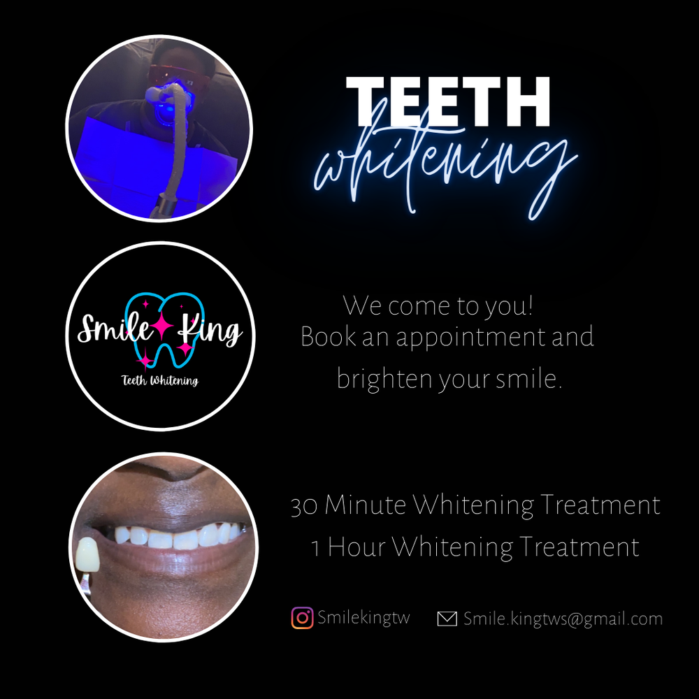 SMILE KING TEETH WHITENING San Francisco, California Teeth