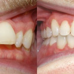 Allegany Orthodontics