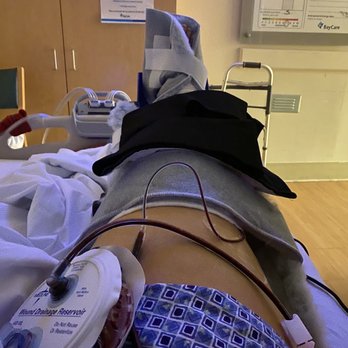 Mixa Orthopedics - A new beginning. 3 hours after surgery - Orthopedists Near Me - South Pasadena, Florida
