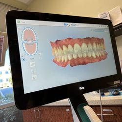 Smile By Design Dental Group - Invisalign scan